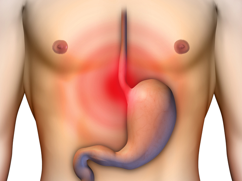 In-Depth Analysis of Acidity: Revealing Its Causes and Symptoms