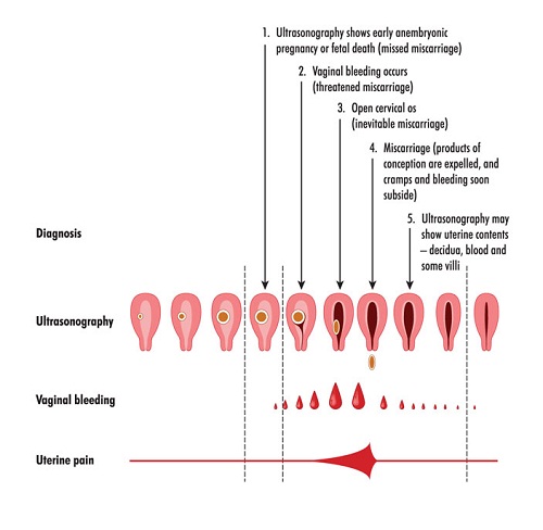Spotting During Pregnancy: Causes and Symptoms | I Fashion Styles