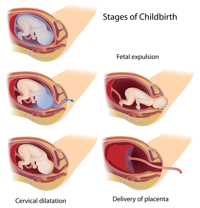 Contractions During Pregnancy - Causes, Symptoms and Types